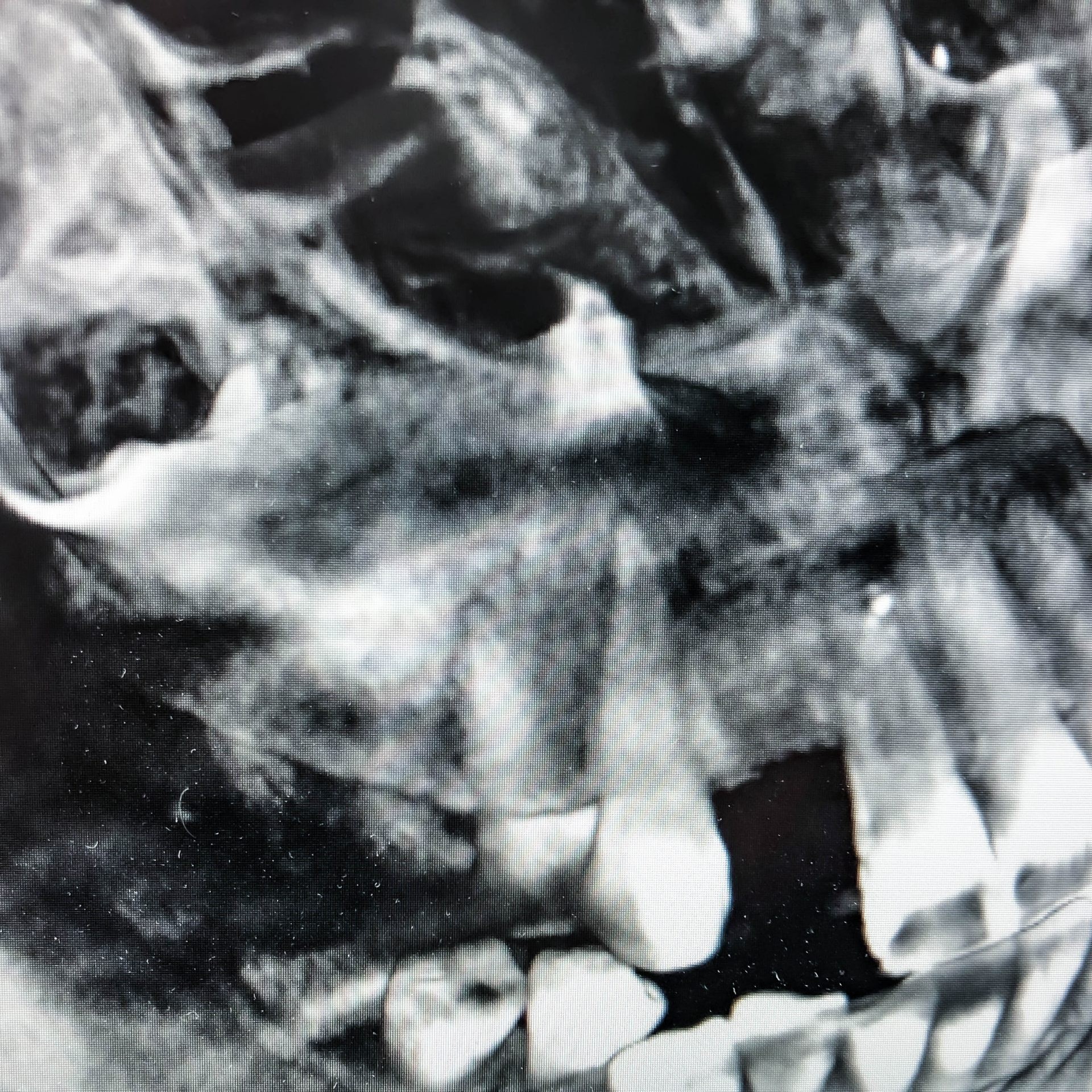 Zahnarzt in Königs Wusterhausen - 3D-Röntgen-Röntgenbild