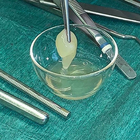 Zahnarzt in Königs Wusterhausen - Eigenblut-PRF-Instrumente