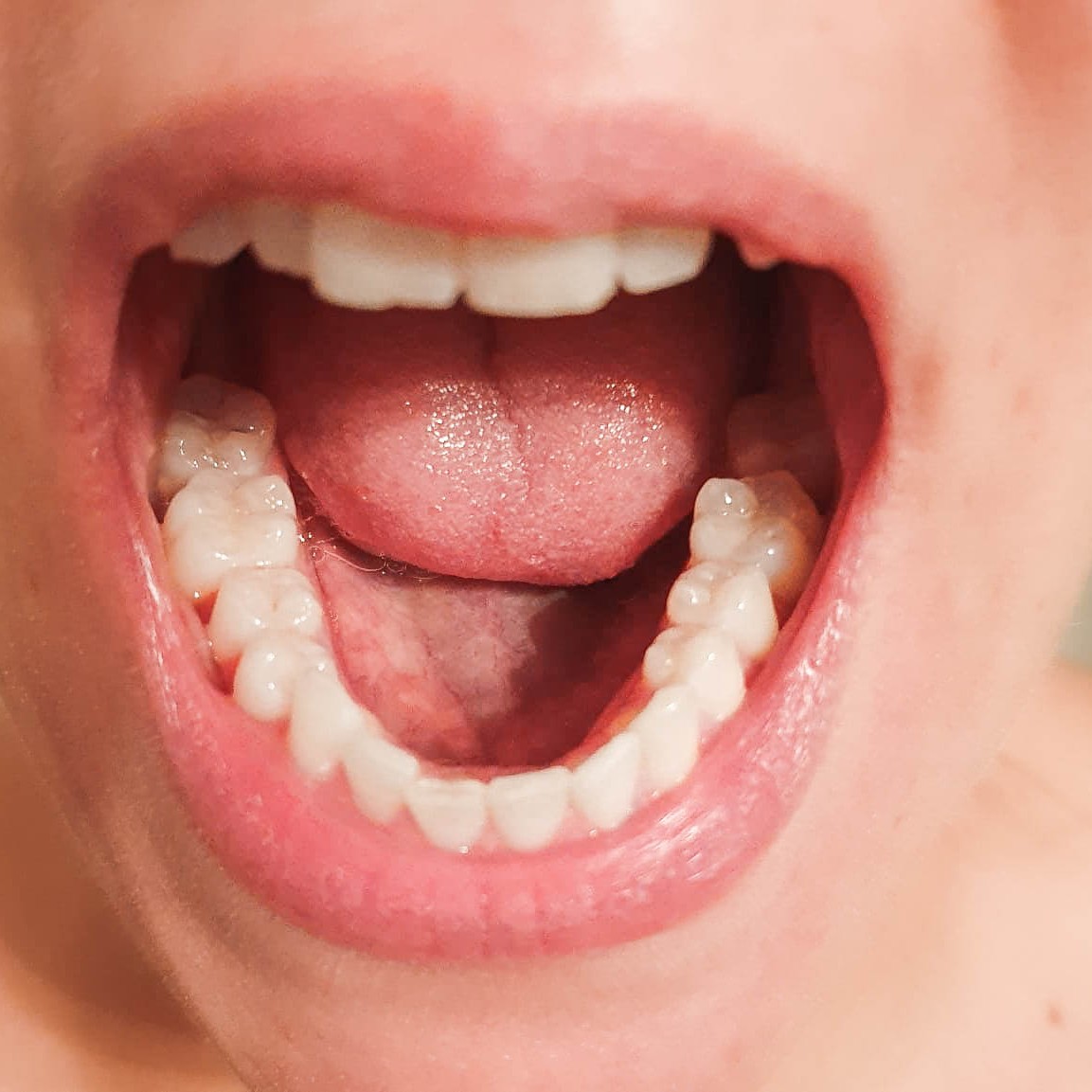 Zahnarzt in Königs Wusterhausen - Mundschleimhaut-Mund-Zähne