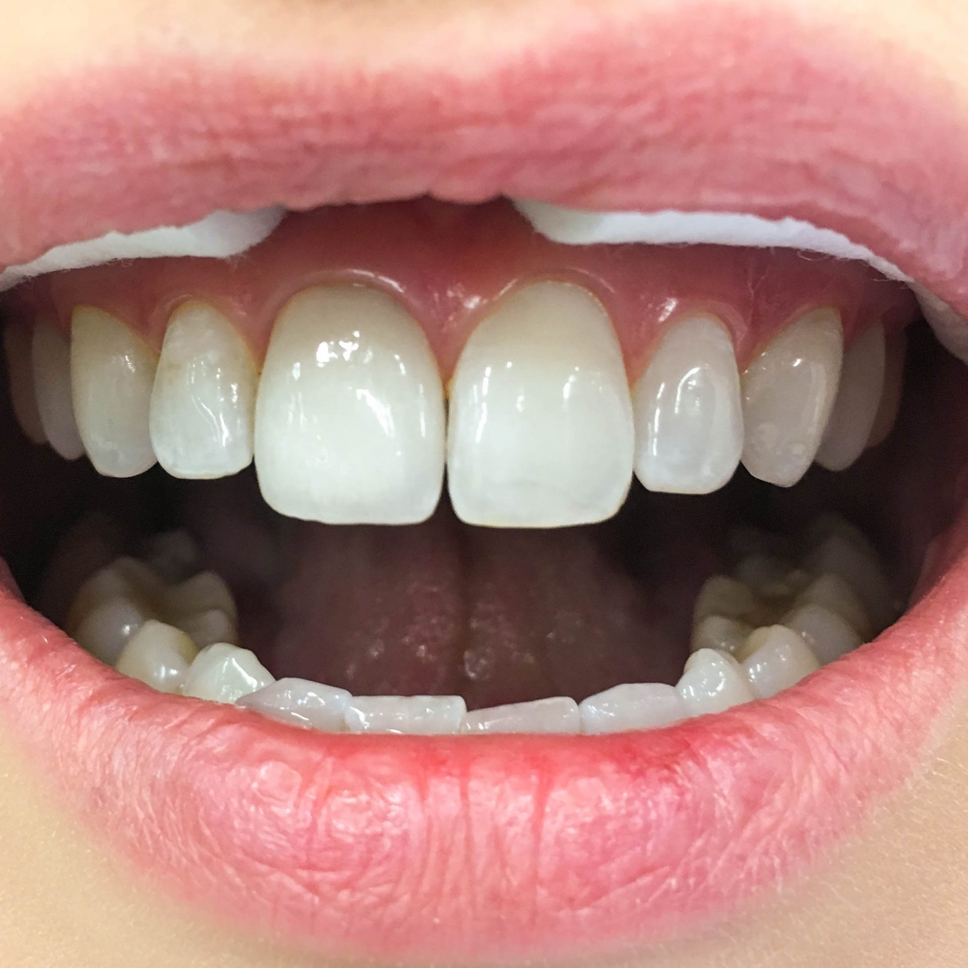 Zahnarzt in Königs Wusterhausen - Prophylaxe-Zähne-Mund