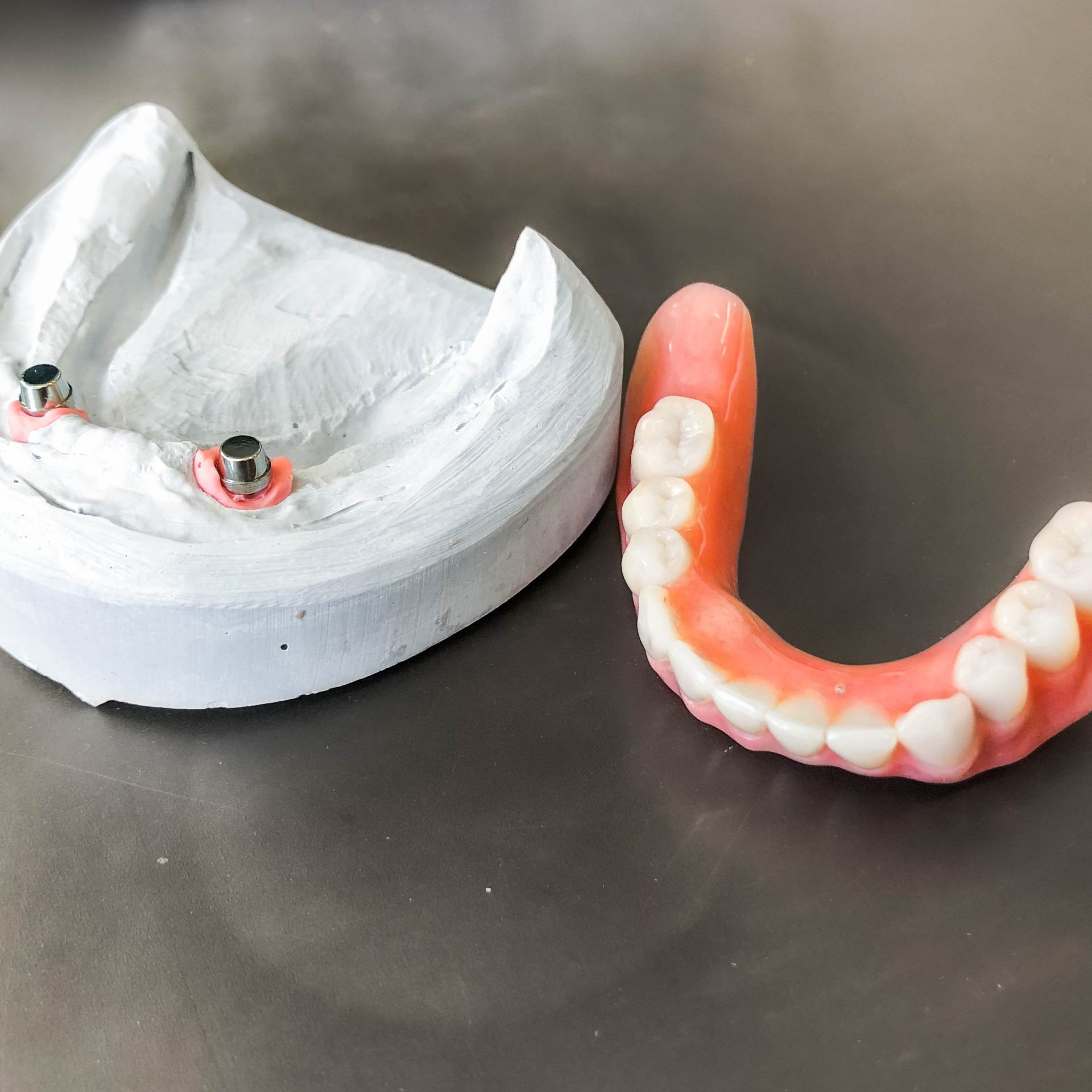 Zahnarzt in Königs Wusterhausen - Zahnersatz-Protese